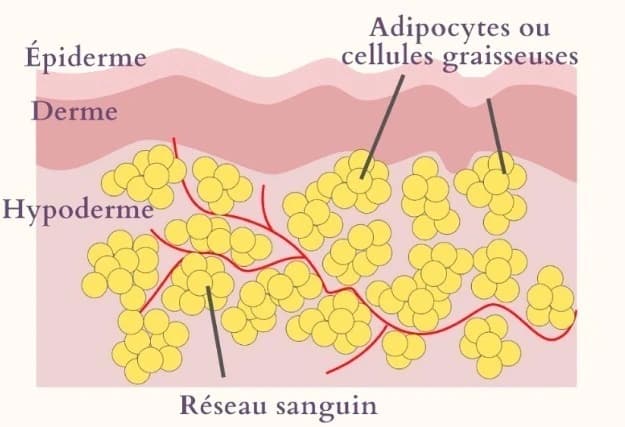 Schéma d'une peau avec cellulite
